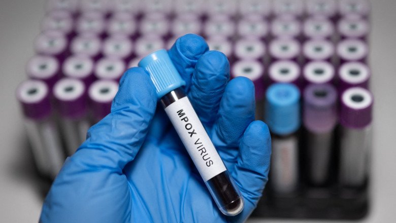 deae8141515963e9122f30064413dd9f-5